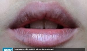 bibir hitam