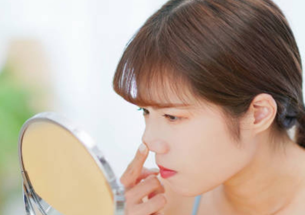 Mengapa Jerawat Sering Muncul di Hidung?