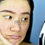 Foto: Ilustrasi wajah kusam tanpa double cleansing (sumber: istock)