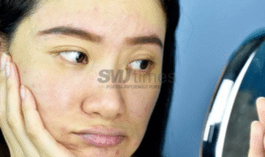Foto: Ilustrasi wajah kusam tanpa double cleansing (sumber: istock)
