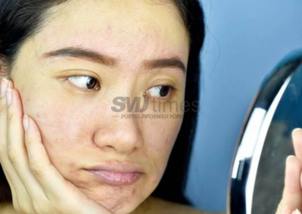 Foto: Ilustrasi wajah kusam tanpa double cleansing (sumber: istock)