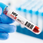 31 Persen Kasus HIV/AIDS di Bali Sepanjang 2025 Disumbang Warga Luar Daerah dan WNA